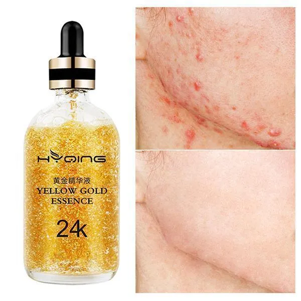24k Gold Moisturizing Essence