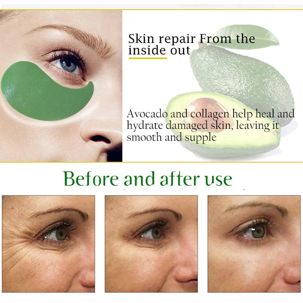 AICHUN BEAUTY 30 Pair Collagen Eye Mask Patch Hydro Gel Pad Anti-Wrinkle Dark Circles Bags Soft Smooth Skin Care Hydration Moisturizing (AVOCADO) Avocado