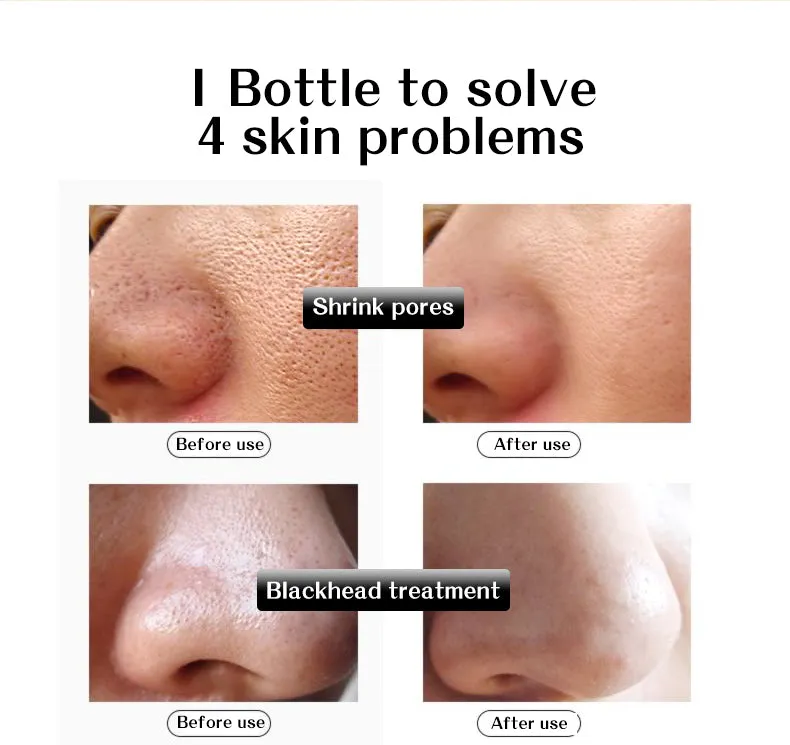 Anti Wrinkle Serum