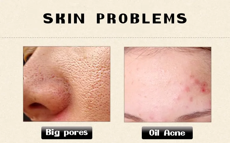 Anti Wrinkle Serum
