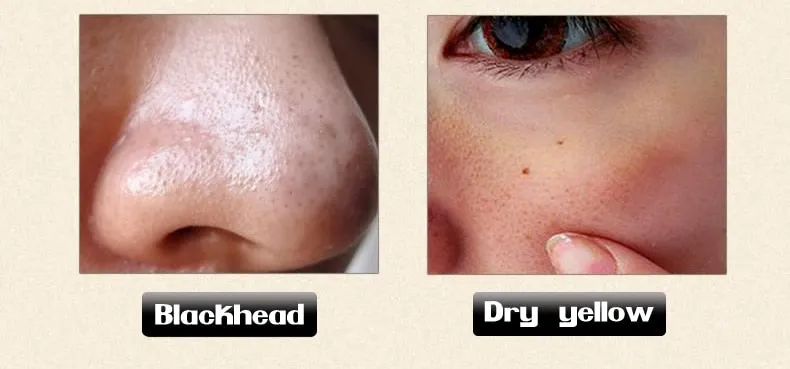 Anti Wrinkle Serum