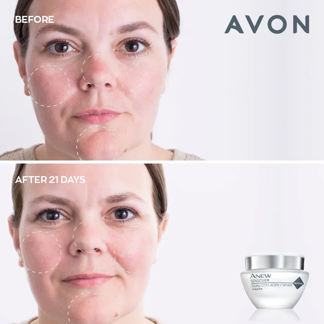 Avon Anew Sensitive  Dual Collagen Collection Set