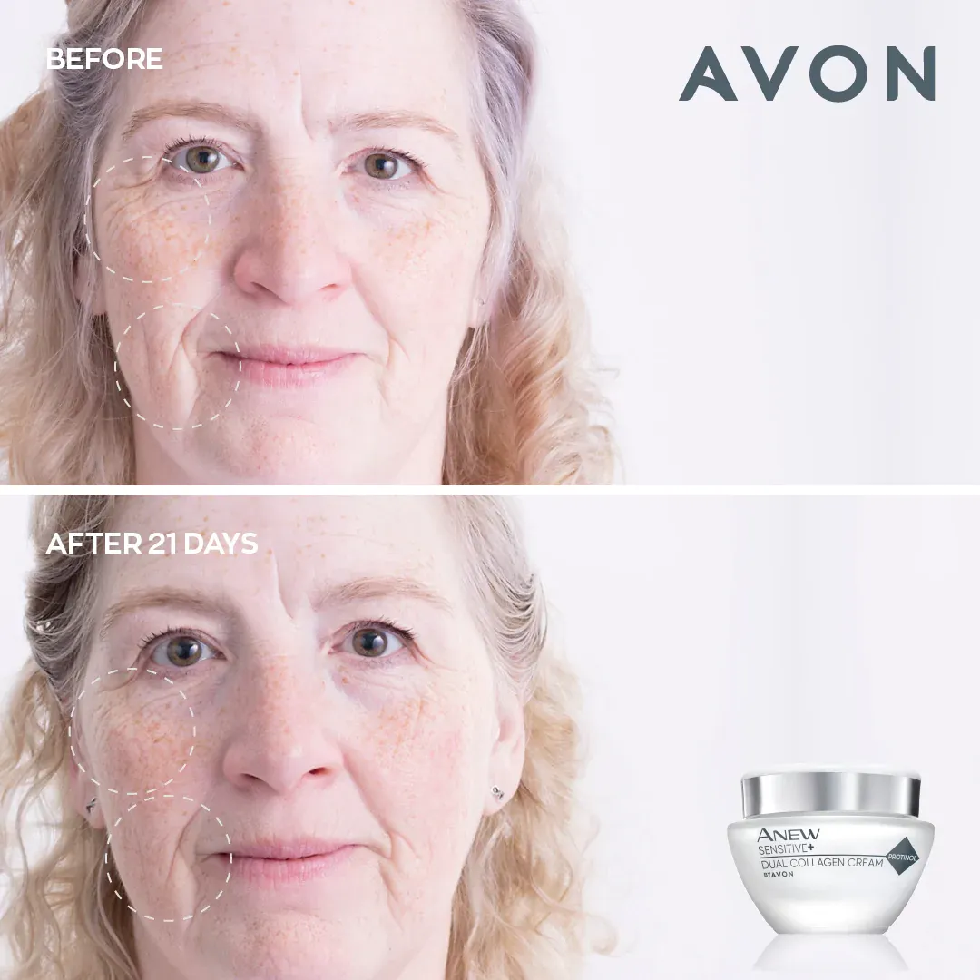 Avon Anew Sensitive  Dual Collagen Collection Set