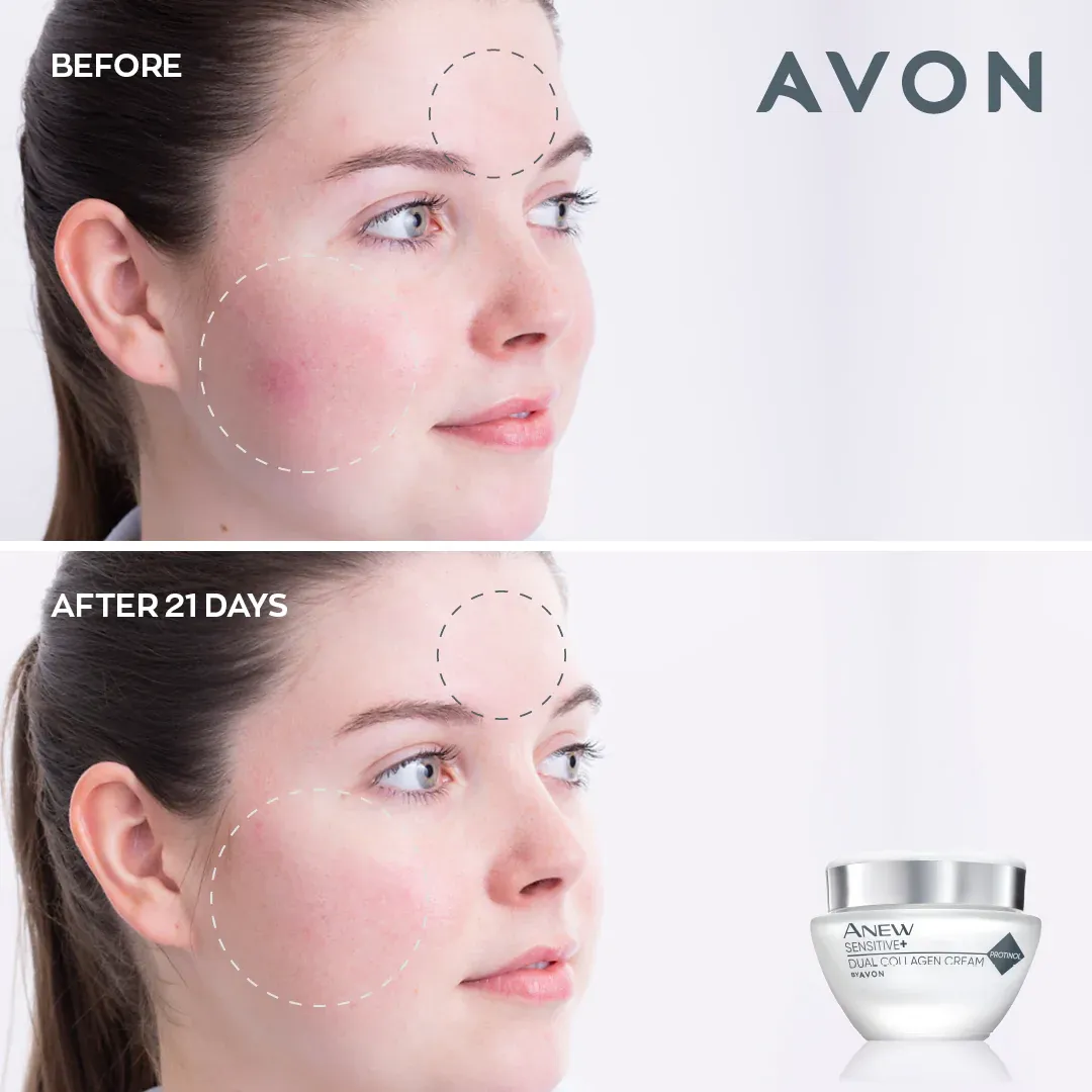 Avon Anew Sensitive  Dual Collagen Collection Set