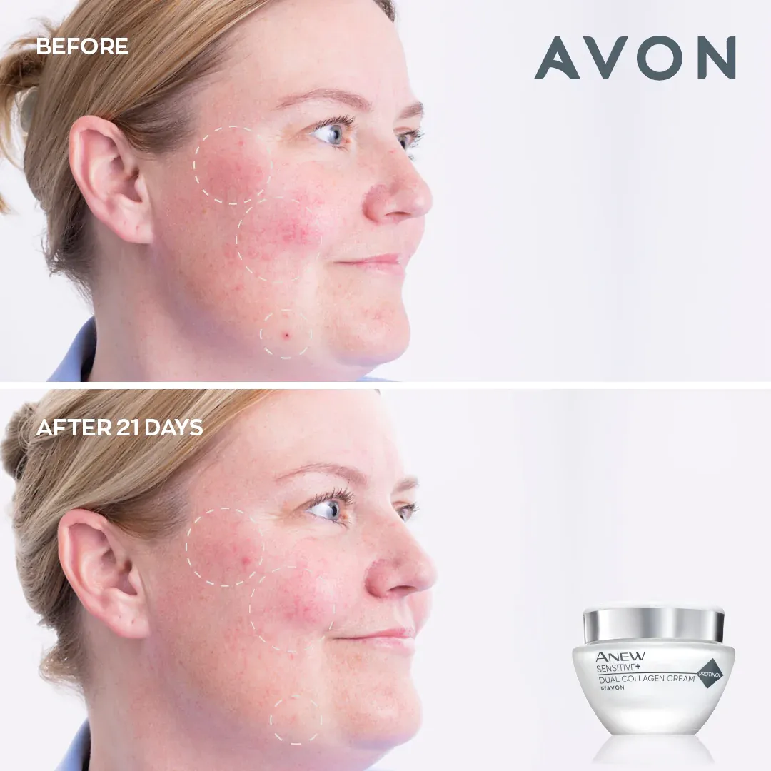Avon Anew Sensitive  Dual Collagen Collection Set