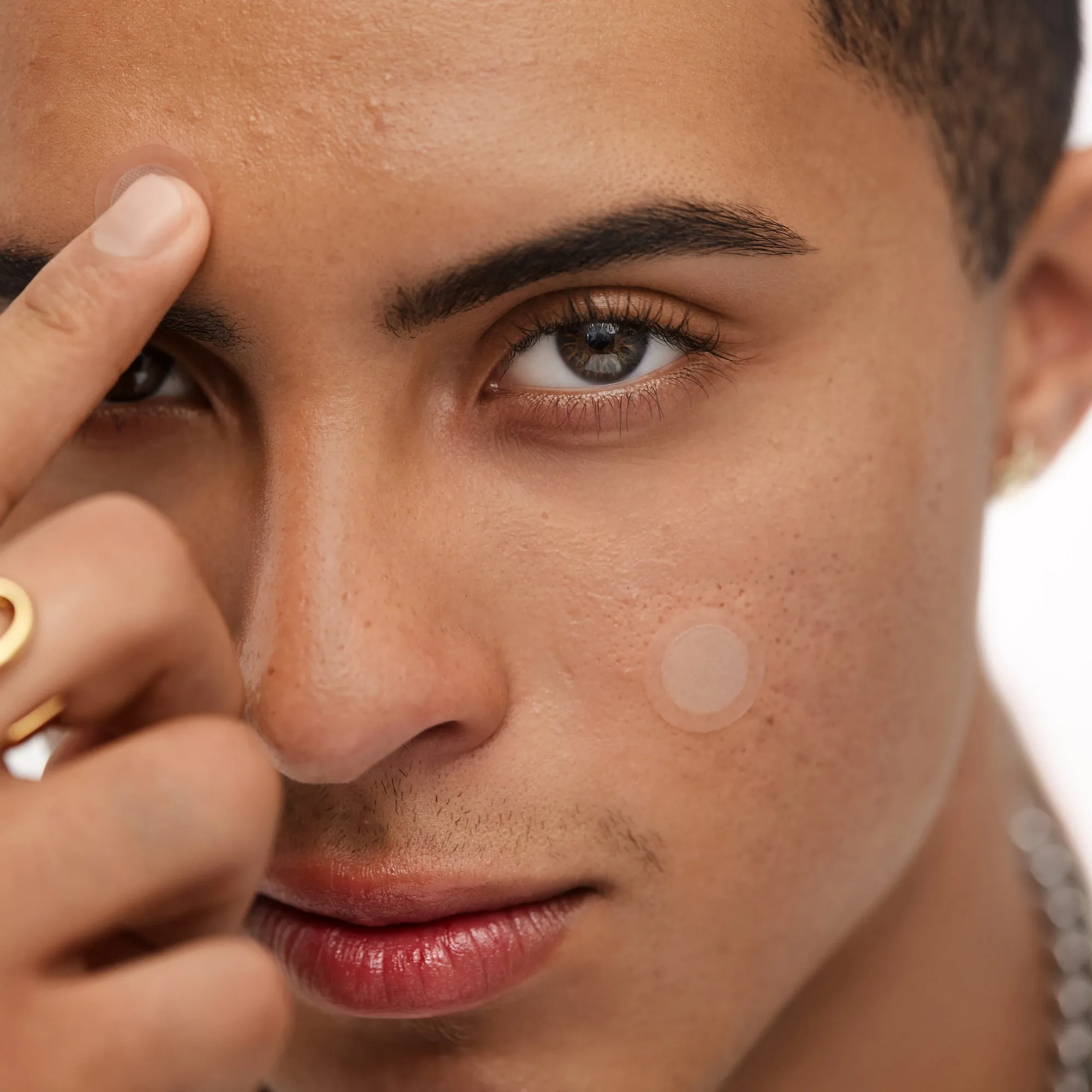 Early Stage Acne Dots