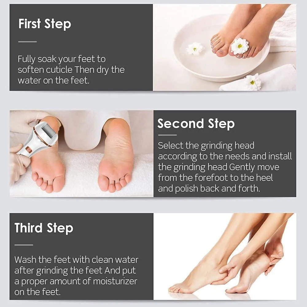 Electric Callus Remover Foot File, Can be Used Wet and Dry