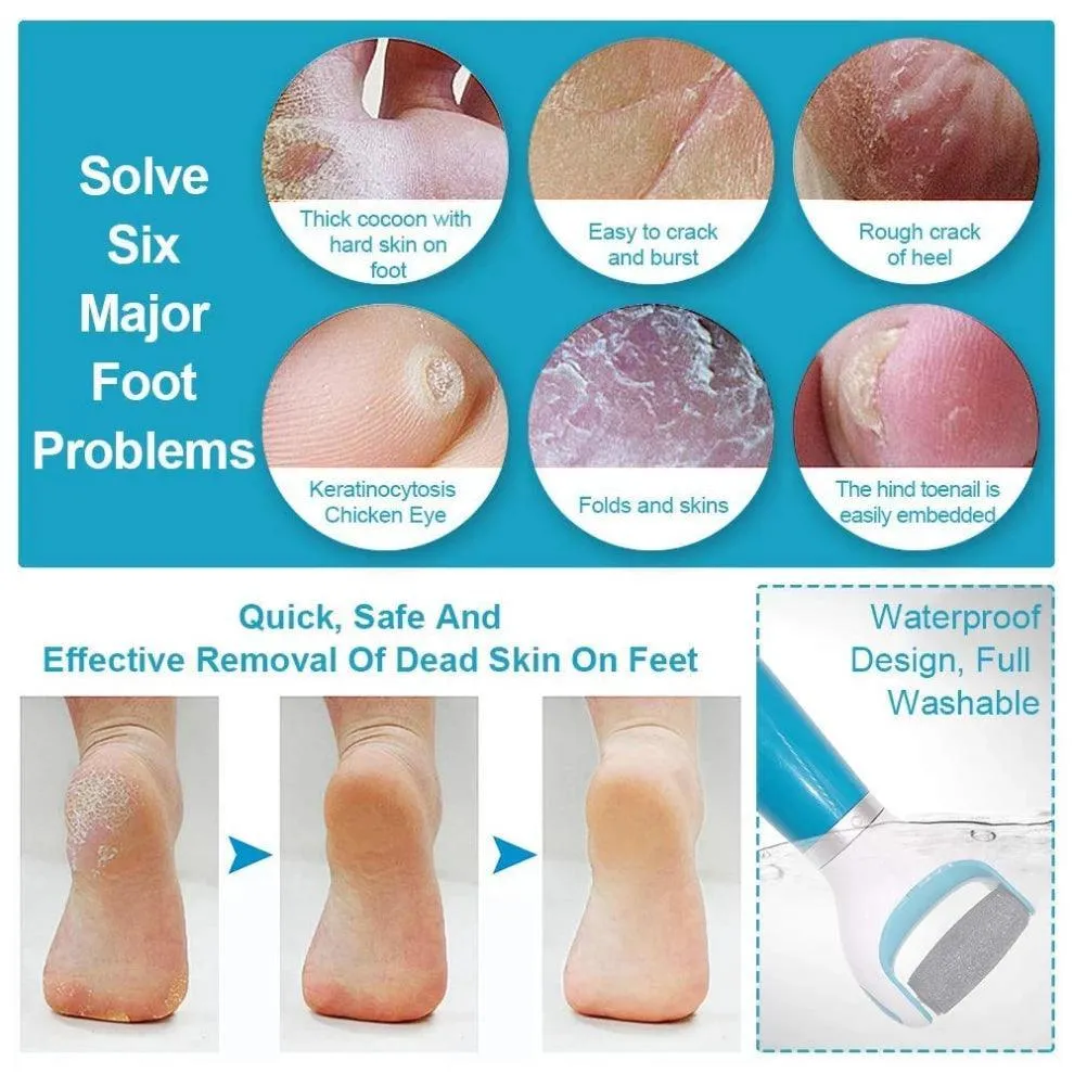 Electric Callus Remover Pedicure Tool - USB