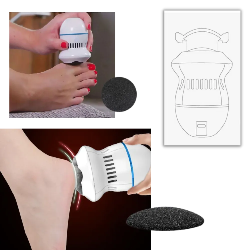 Electric Callus Remover