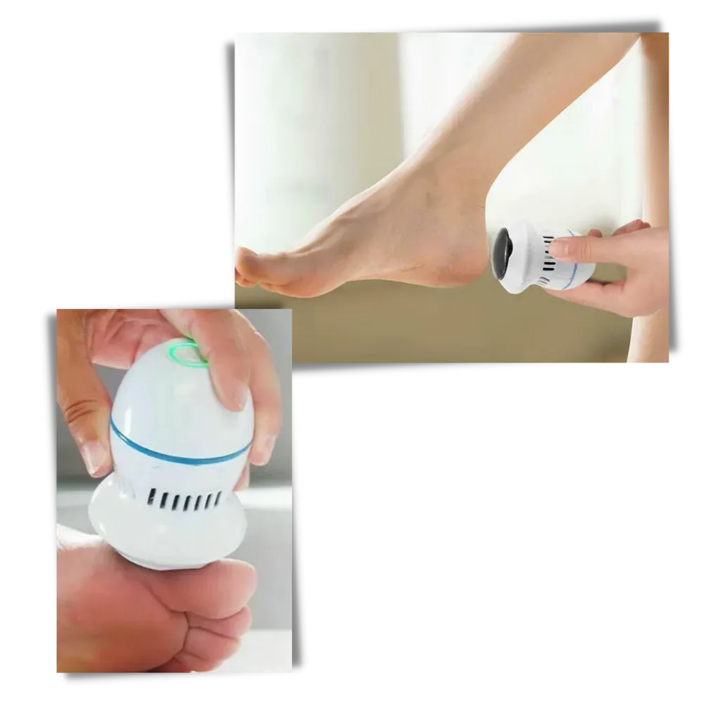 Electric Callus Remover