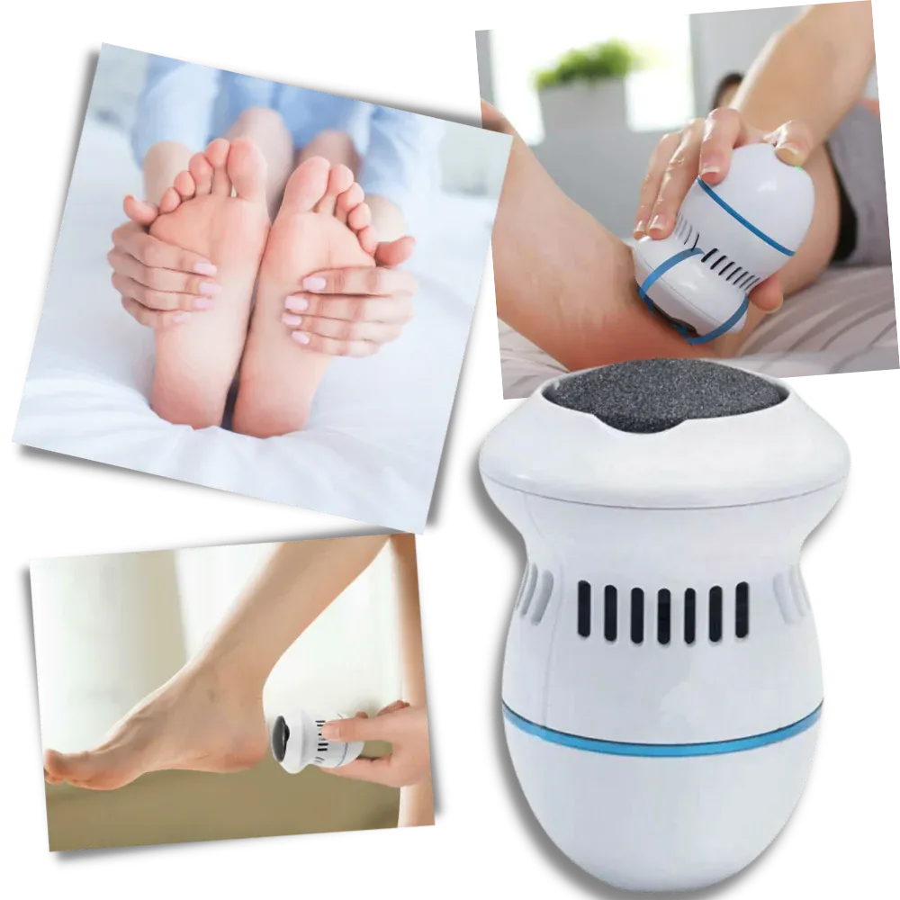 Electric Callus Remover