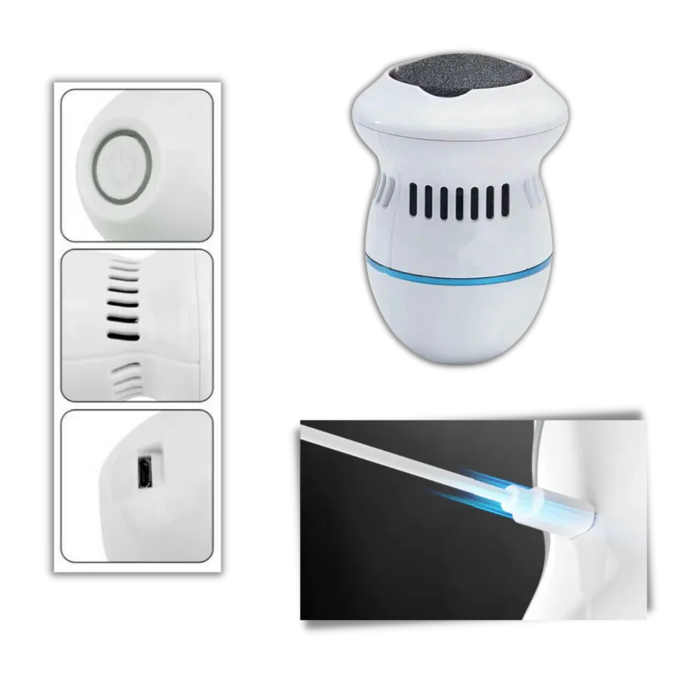 Electric Callus Remover