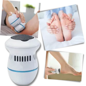 Electric Callus Remover