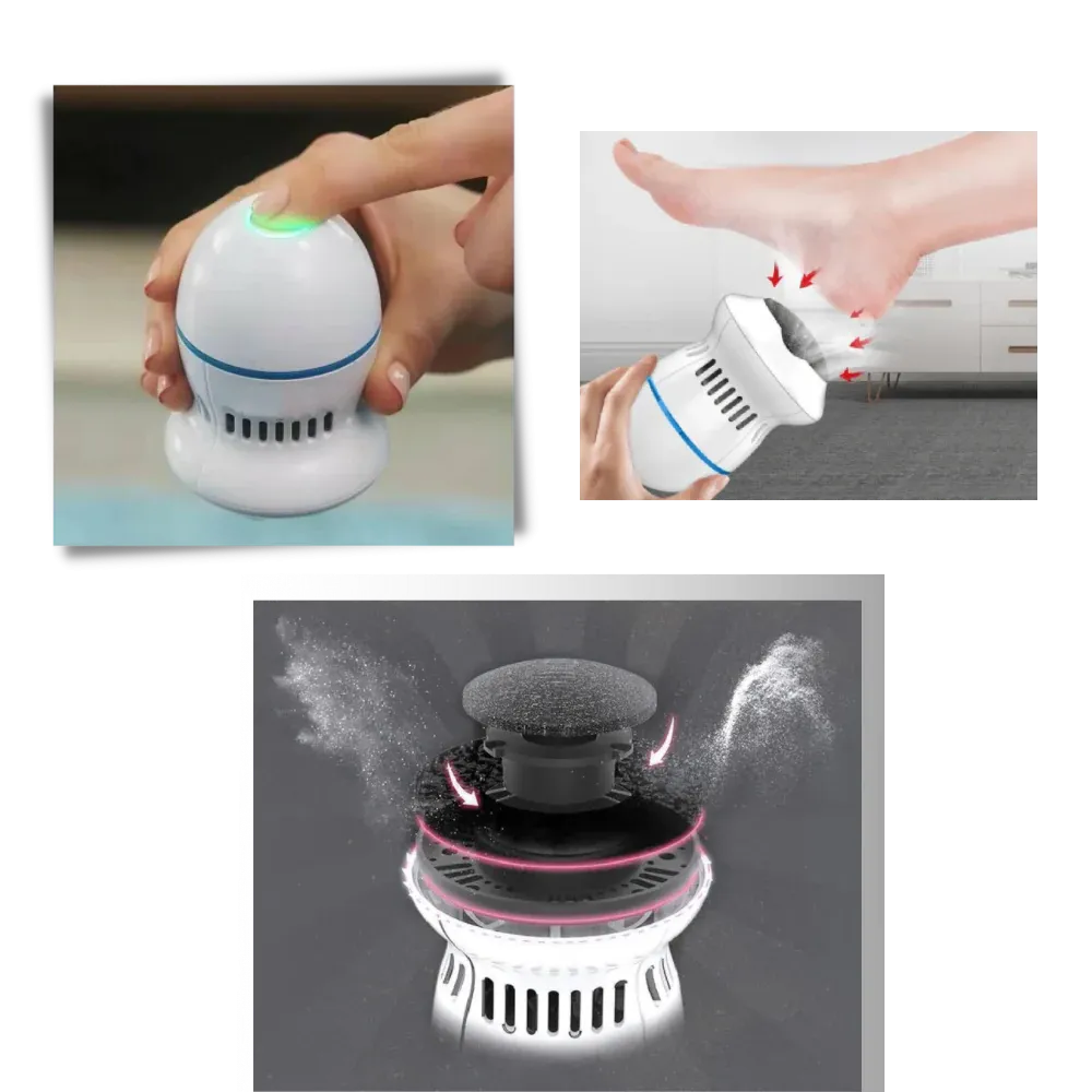 Electric Callus Remover