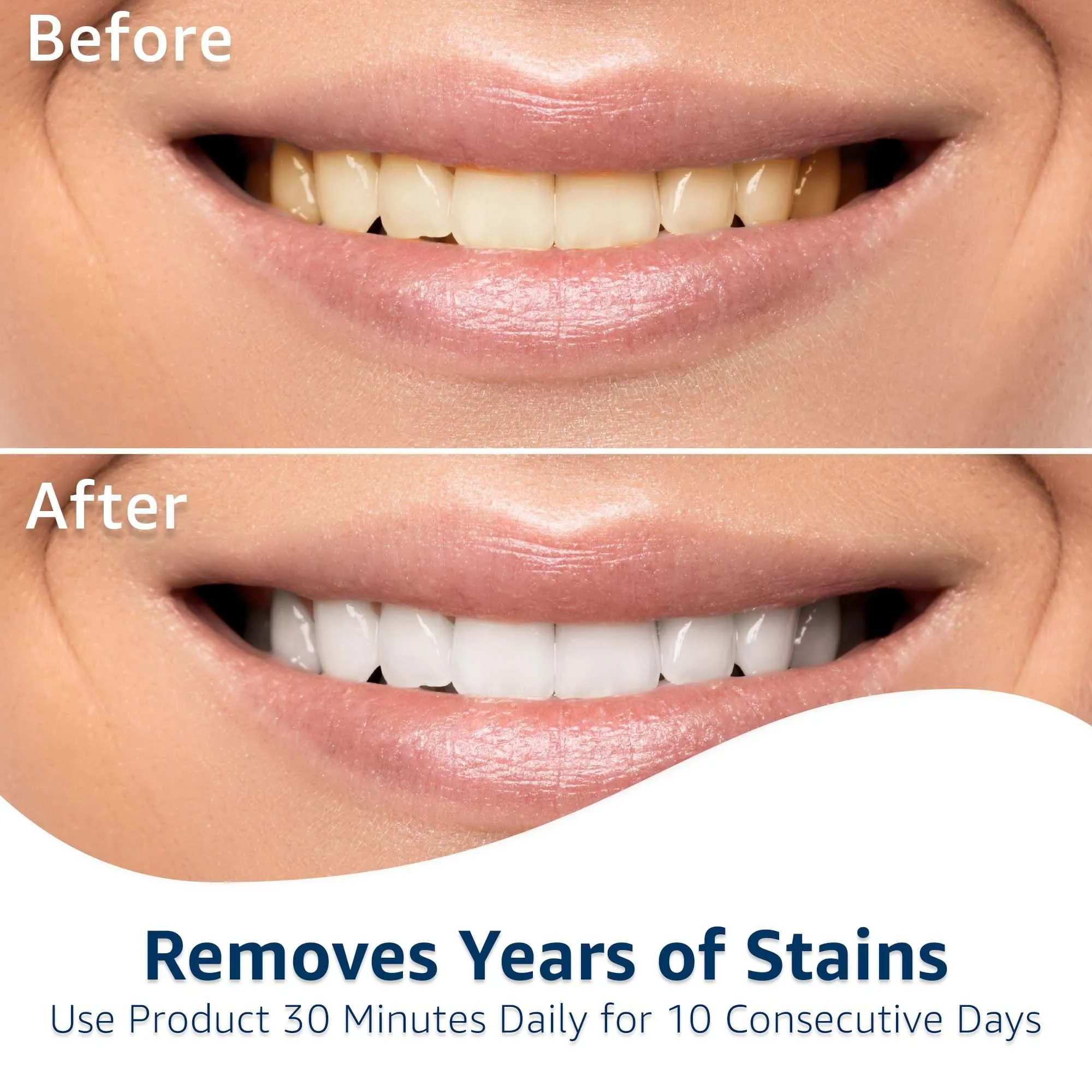 Equate Timeless White Whitening Strips, Enamel-Safe, 20 Whitening Strips (10 Treatments)