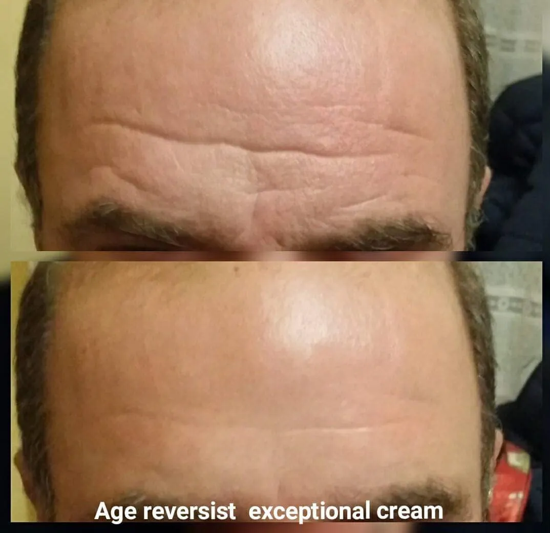 Exceptional Cream 30 PCS-Age Reversist | Dr. C. Tuna | Farmasi