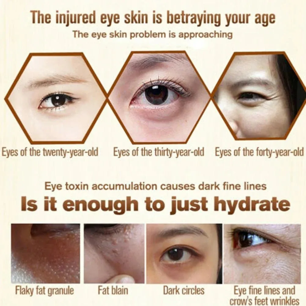 Firming Fat Granules Remover Eye Cream Improve Eye Bag Fade Fine Lines Moisturizing Anti-Puffiness Lifting Skin Care