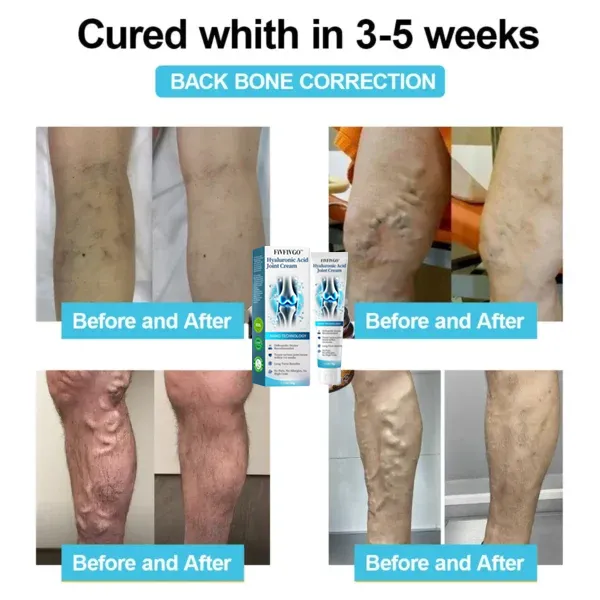 Fivfivgo™ Hyaluronic Acid Joint Repair Cream