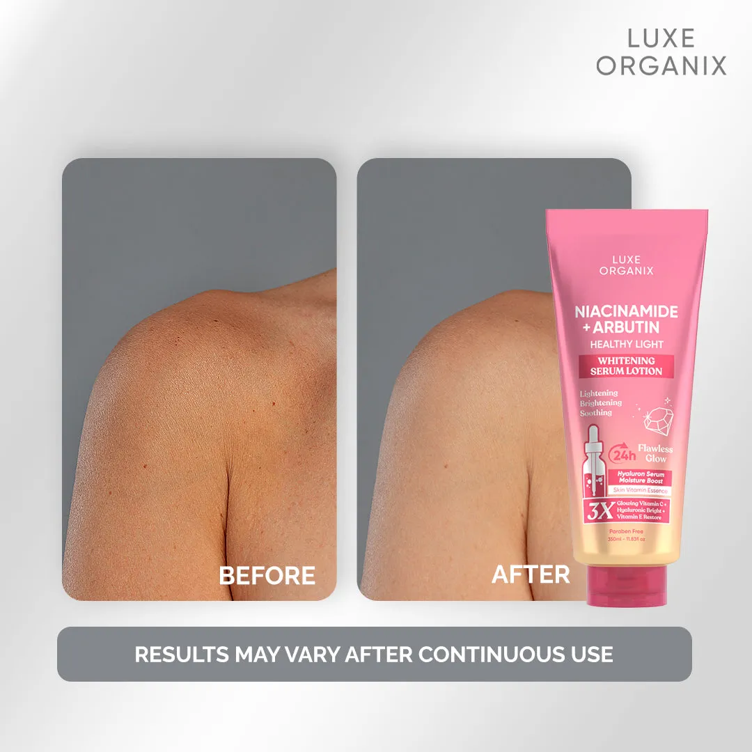 Luxe Organix - NIACINAMIDE   ALPHA ARBUTIN WHITENING SERUM LOTION 350ML ( PINK )