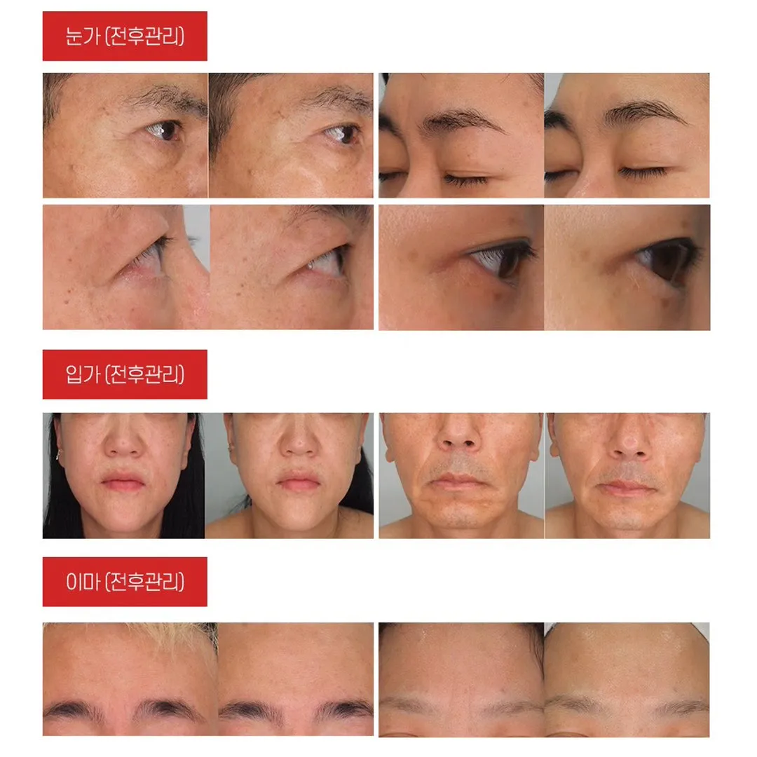 Madnice  No Gravity Lifting Mask - Anti-Aging - 6 Sheets