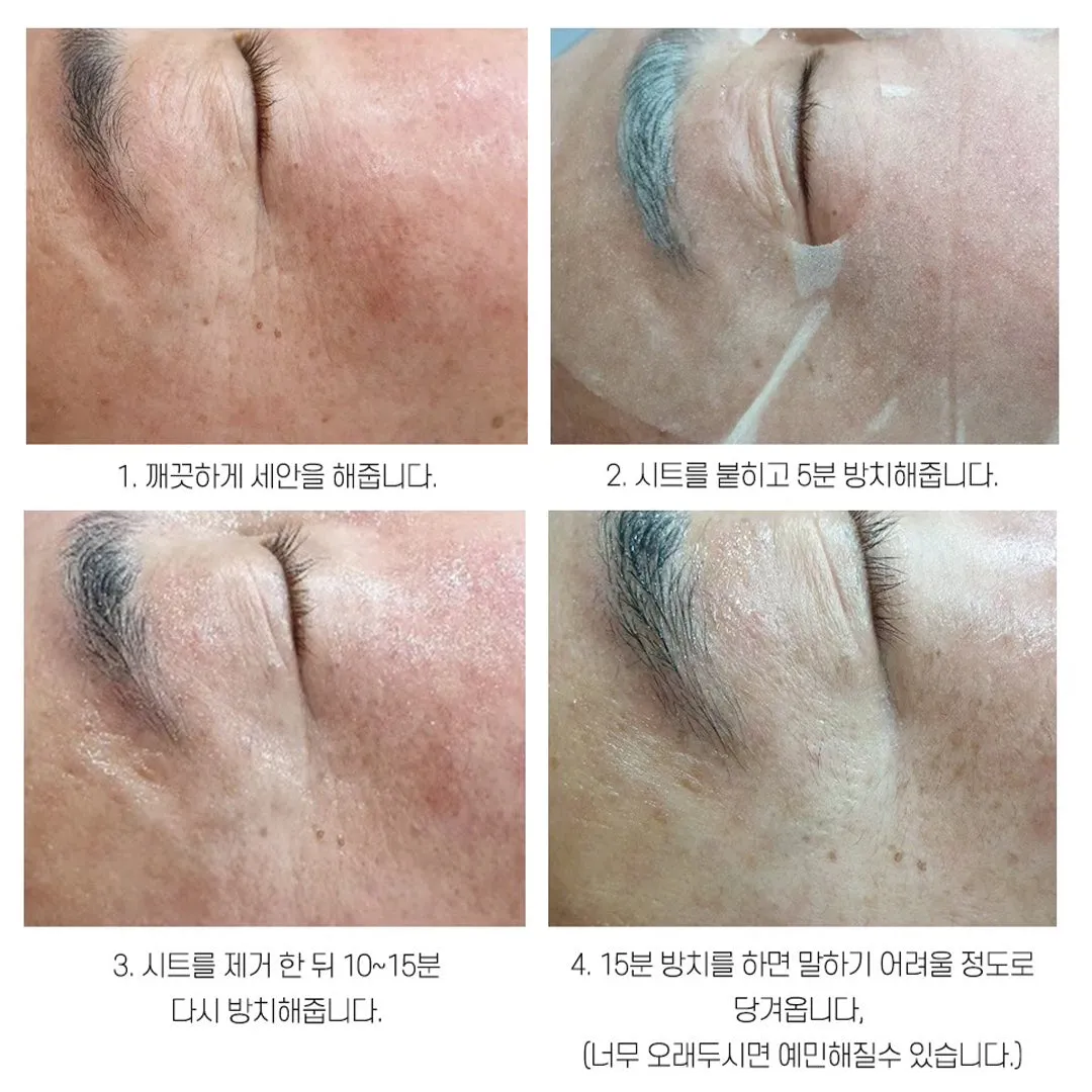 Madnice  No Gravity Lifting Mask - Anti-Aging - 6 Sheets