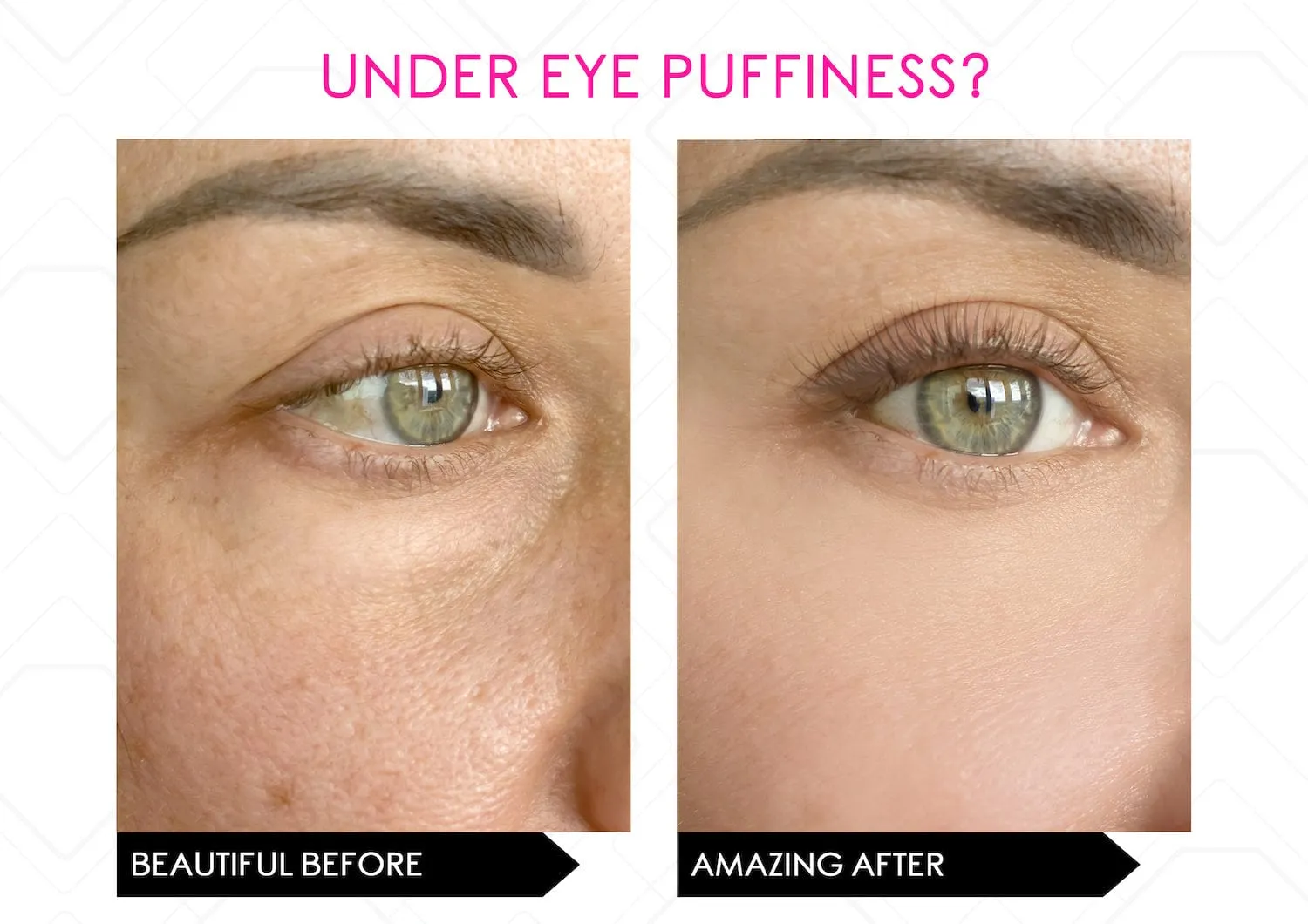 Power Lift Full-Size Skin Saviours - Express Skin Renew & Anti-Ageing