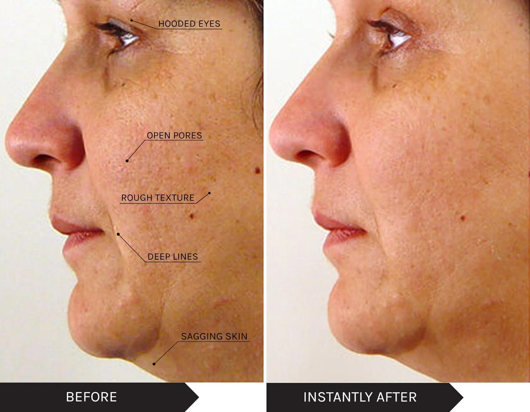 Power Lift Full-Size Skin Saviours - Express Skin Renew & Anti-Ageing