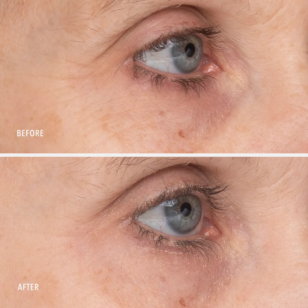 Retinol Eye Renewal