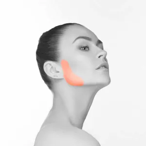 Sideburn Laser Hair Removal for Women in NYC