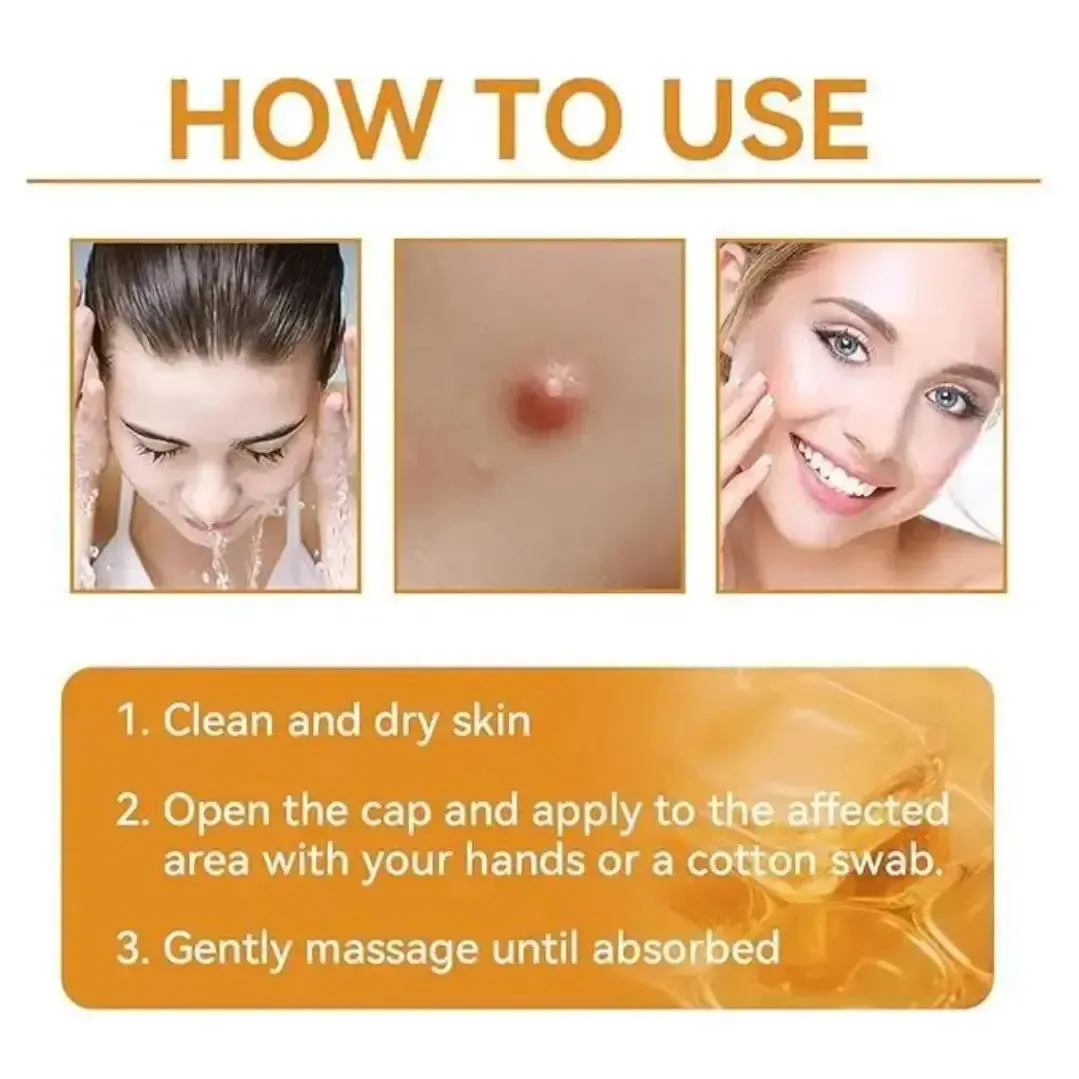 Skin Tag Removal Cream | Bee Venom Skin Treatment Cream 100g (Pack of 2)