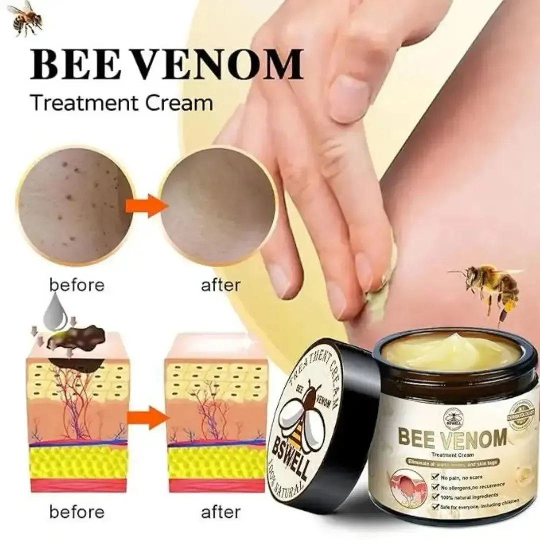 Skin Tag Removal Cream | Bee Venom Skin Treatment Cream 100g (Pack of 2)