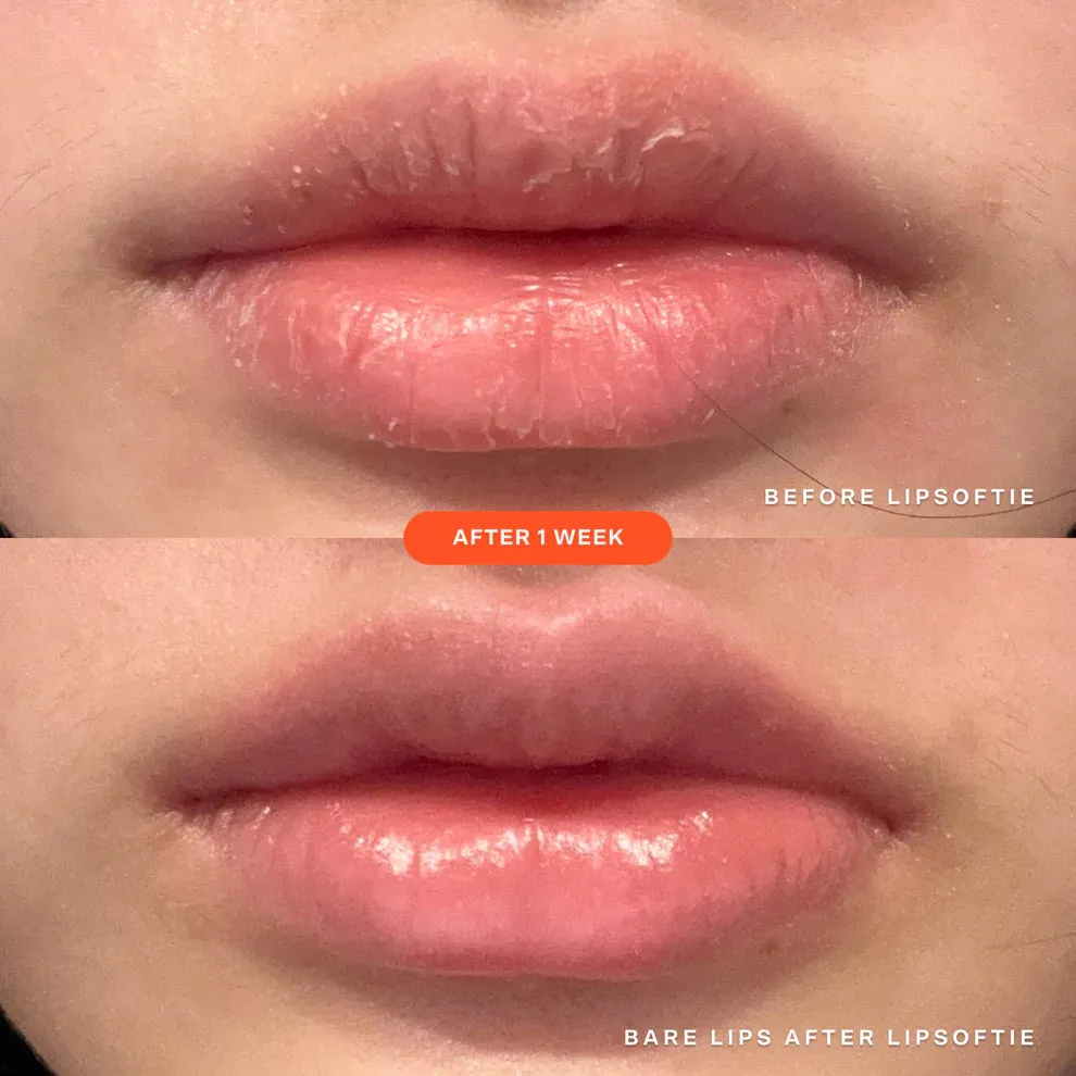 Tower 28 - LipSoftie™ Lip Treatment - SOS Vanilla (Clear)