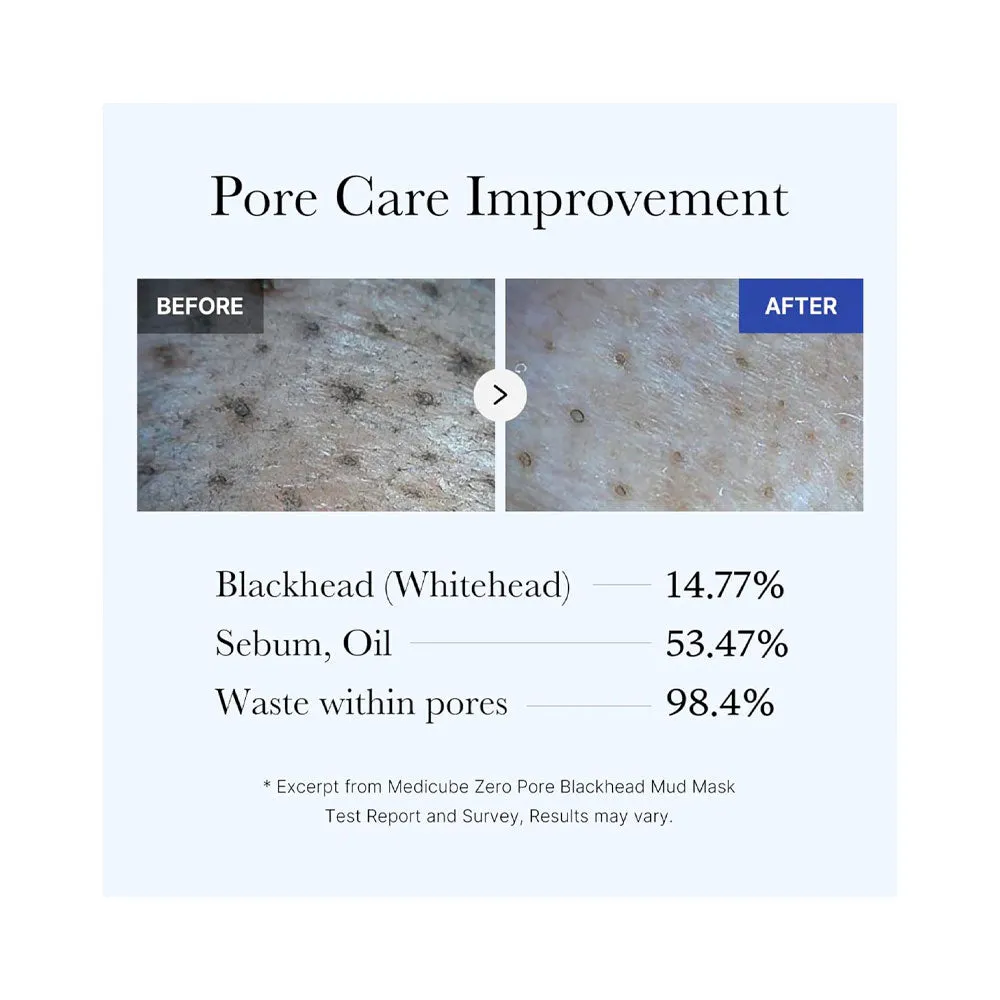 Zero Pore Blackhead Mud Mask